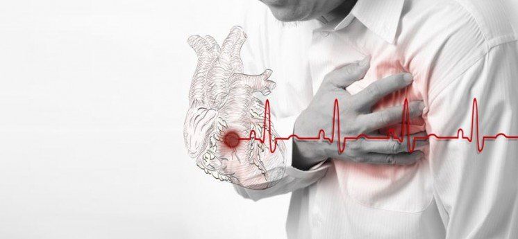 Інфаркт у 21 рік – патологія загрожує життю наших співгромадян