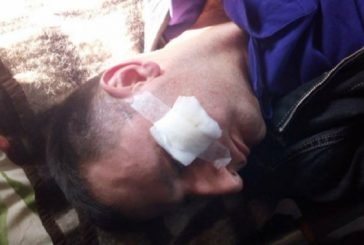 На Тернопільщини побили журналістів з Волинської області (ФОТО, ВІДЕО)