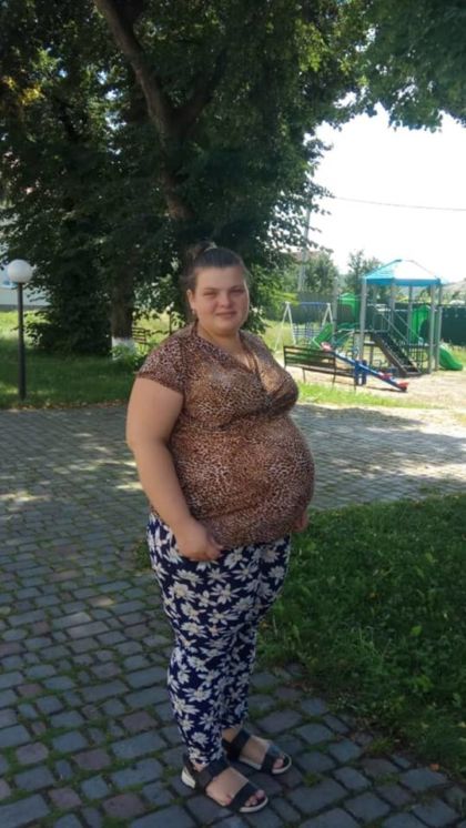 На Тернопільщині жінка захворіла кором та втратила дитину на 9 місяці вагітності