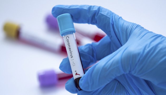 В Україні зареєстрували 84 хворих на коронавірус