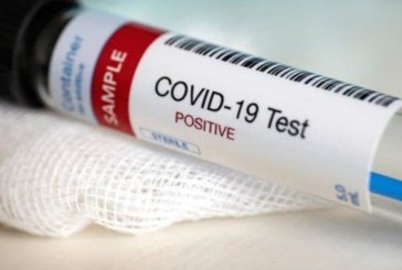 У Тернопільській області у 57 людей виявили коронавірус