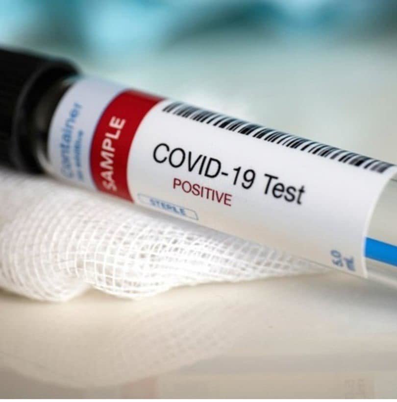Заробити на пандемії: шахраї продають по 20 євро тест-системи для виявлення коронавірусу