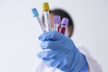 У Тернополі всім пацієнтам перед операціями робитимуть тести на коронавірус