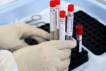 1 вересня: в Україні – 2088 нових випадків коронавірусу