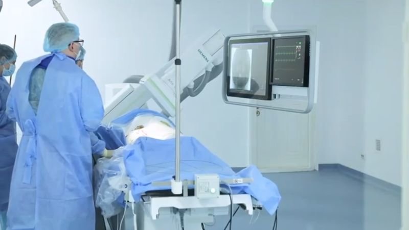 Тернопільські медики зробили унікальну операцію на судинах мозку