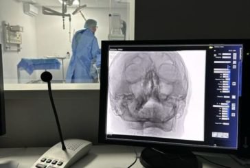 Медики Тернопільщини мають змогу діагностувати патології судин головного мозку та проводити складні операції