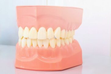 Правильний прикус зубів: яким він має бути та як виправити