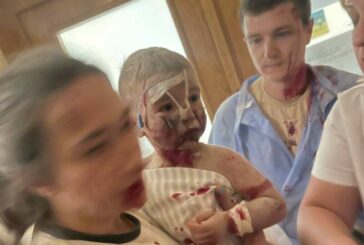 Поранений «Охматдит»: ООН, ЮНІСЕФ, Червоний Хрест, Білий дім, - не мовчіть! путін вбиває українських дітей